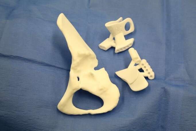 3D printed pelvic and PSI